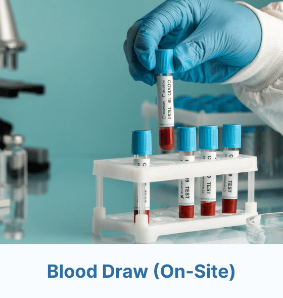Blood Draw (On-Site)