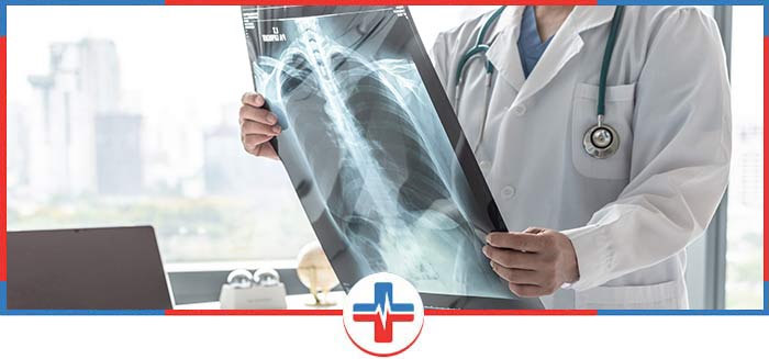 Cheapest x ray near me